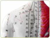 Acupuncture